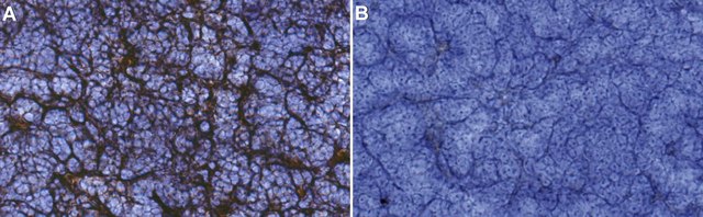 Anti-Cortical stromal cells Antibody, clone ER-TR4