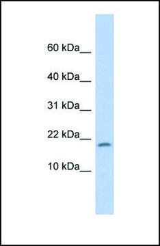 Anti-RPS15 antibody produced in rabbit affinity isolated antibody