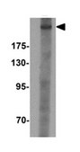 Anti-CHD7 Antibody from rabbit, purified by affinity chromatography