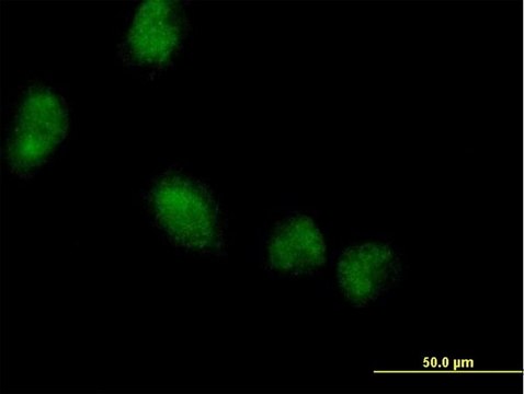 Anti-LMCD1 antibody produced in mouse purified immunoglobulin, buffered aqueous solution