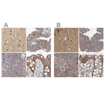 Anti-TSPOAP1 antibody produced in rabbit Prestige Antibodies&#174; Powered by Atlas Antibodies, affinity isolated antibody, buffered aqueous glycerol solution, Ab1