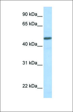 Anti-CALCRL antibody produced in rabbit affinity isolated antibody