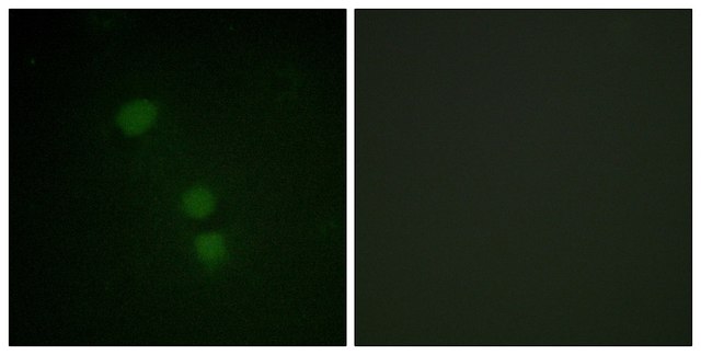 Anti-Histone H2B (Acetyl-Lys15) antibody produced in rabbit affinity isolated antibody