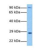 Anti-SURF4 antibody produced in rabbit affinity isolated antibody