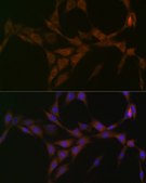 Anti-15-PGDH/HPGD Antibody, clone 2X4N7, Rabbit Monoclonal