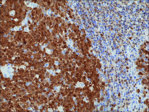 Anti-BOB-1/OBF-1 antibody, Rabbit monoclonal recombinant, expressed in HEK 293 cells, clone RM378, purified immunoglobulin