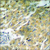 Anti-phospho-DAPK2 (pSer318) antibody produced in rabbit affinity isolated antibody