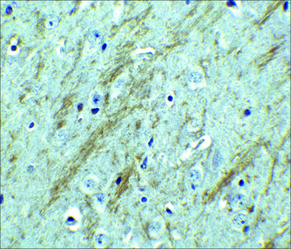 Anti-BACE antibody produced in rabbit IgG fraction of antiserum, buffered aqueous solution