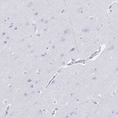 Anti-GPBAR1 antibody produced in rabbit Prestige Antibodies® Powered by Atlas Antibodies, affinity isolated antibody, buffered aqueous glycerol solution