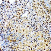 Anti-ENT2/SLC29A2 Antibody, clone 7B2J3, Rabbit Monoclonal