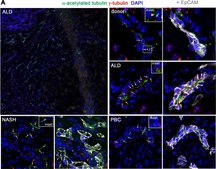 抗-γ-微管蛋白 affinity isolated antibody, buffered aqueous solution