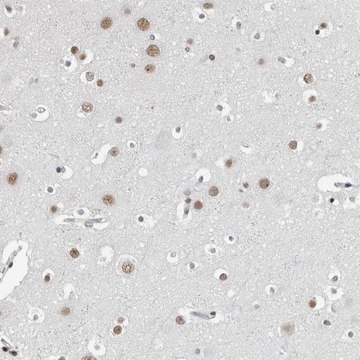 Anti-ORC1 antibody produced in rabbit Prestige Antibodies® Powered by Atlas Antibodies, affinity isolated antibody, buffered aqueous glycerol solution