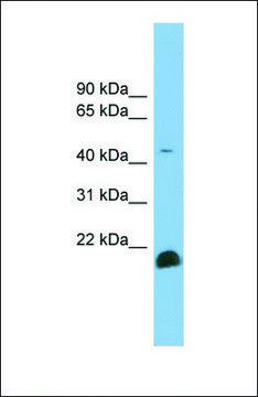 Anti-TGFB2 antibody produced in rabbit affinity isolated antibody