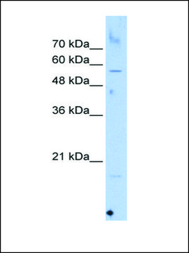 Anti-SEPN1 antibody produced in rabbit affinity isolated antibody