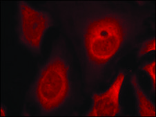 Anti-phospho-EIF2S1 (pSer49) antibody produced in rabbit affinity isolated antibody