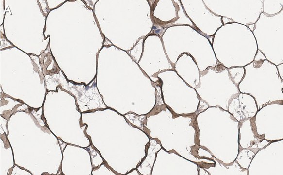 Anti-FASN Antibody, clone 2C13 ZooMAb&#174; Rabbit Monoclonal recombinant, expressed in HEK 293 cells