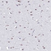 Anti-NOP56 antibody produced in rabbit Prestige Antibodies® Powered by Atlas Antibodies, affinity isolated antibody, buffered aqueous glycerol solution