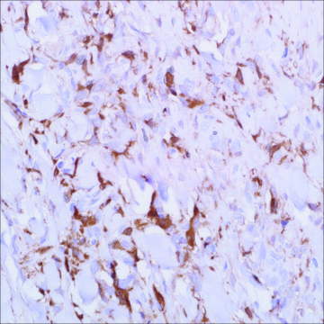 Factor XIIIa (AC-1A1) Mouse Monoclonal Antibody