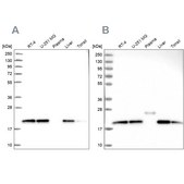 Anti-NDUFA8 antibody produced in rabbit Prestige Antibodies® Powered by Atlas Antibodies, affinity isolated antibody, buffered aqueous glycerol solution