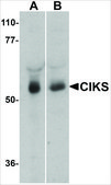 Anti-CIKS antibody produced in rabbit affinity isolated antibody, buffered aqueous solution