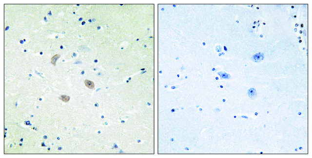 Anti-AKT2 antibody produced in rabbit affinity isolated antibody