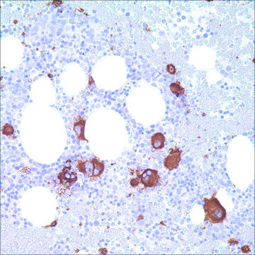 CD61 (2f2) Mouse Monoclonal Antibody