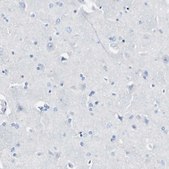 Anti-LAG3 antibody produced in rabbit Prestige Antibodies® Powered by Atlas Antibodies, affinity isolated antibody, buffered aqueous glycerol solution