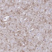 Anti-CREG2 antibody produced in rabbit Prestige Antibodies® Powered by Atlas Antibodies, affinity isolated antibody, buffered aqueous glycerol solution