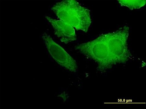 Anti-ECH1 antibody produced in mouse purified immunoglobulin, buffered aqueous solution