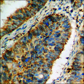 Anti-phospho-IRS-1 (pSer636) antibody produced in rabbit affinity isolated antibody