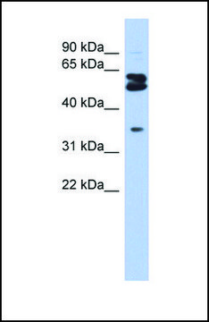 Anti-OGFOD1 antibody produced in rabbit affinity isolated antibody