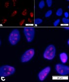 BioTracker™ rRNA Live Cell Probe Fluorescent detection of ribosomal RNA and cell nucleoli