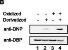 Anti-Vitamin D-Binding Protein/GC antibody produced in goat affinity isolated antibody, buffered aqueous solution