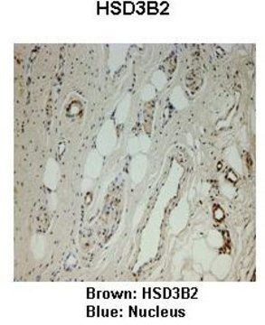 Anti-HSD3B2 affinity isolated antibody