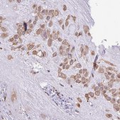 Anti-SGPP1 antibody produced in rabbit Prestige Antibodies® Powered by Atlas Antibodies, affinity isolated antibody, buffered aqueous glycerol solution