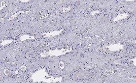 Anti-Pyk2/PTK2B Antibody, clone 3B7 ZooMAb® Rabbit Monoclonal recombinant, expressed in HEK 293 cells