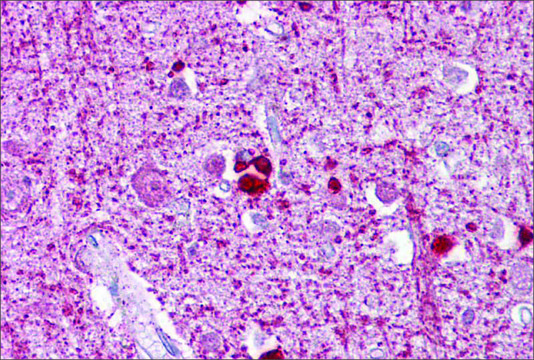 Anti-ZEB2 antibody produced in rabbit affinity isolated antibody