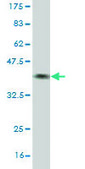 Monoclonal Anti-BBS7 antibody produced in mouse clone 2H6, purified immunoglobulin, buffered aqueous solution