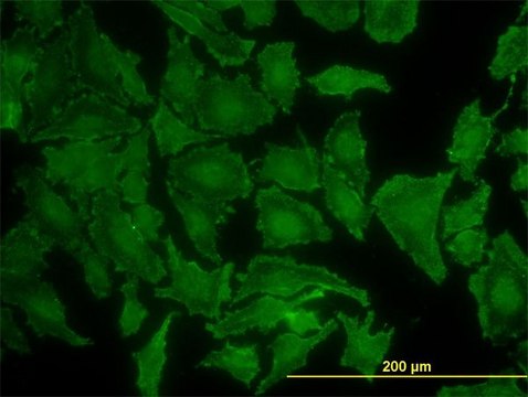 单克隆抗 KRAS 小鼠抗 clone 3B10-2F2, purified immunoglobulin, buffered aqueous solution