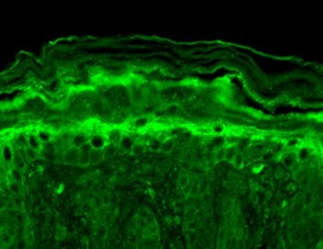 Monoclonal Anti-KCNT1 antibody produced in mouse clone S3-26, 1&#160;mg/mL, purified immunoglobulin