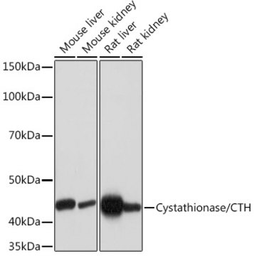 Anti-Cystathionase/CTH Antibody, clone 7L3D0, Rabbit Monoclonal