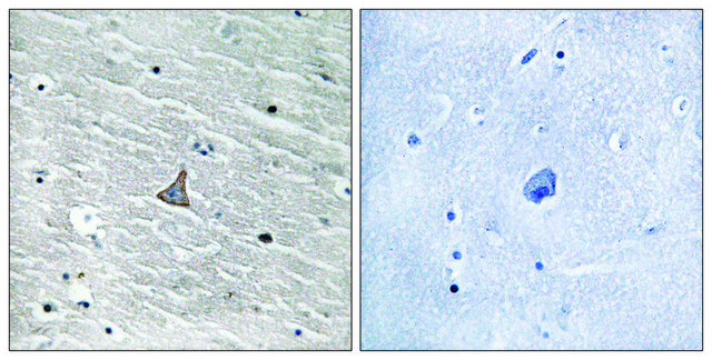 Anti-VHL antibody produced in rabbit affinity isolated antibody