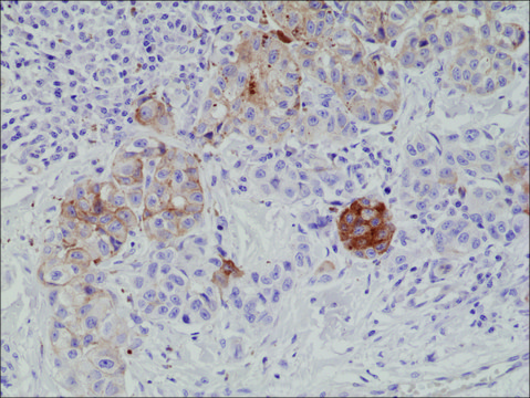 Anti-MART1 antibody, Rabbit monoclonal recombinant, expressed in HEK 293 cells, clone RM333, purified immunoglobulin