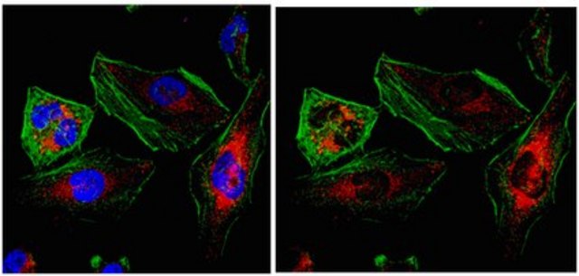 Anti-NET34 Antibody from rabbit, purified by affinity chromatography