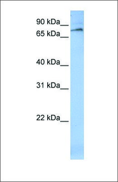 Anti-ALOX12 antibody produced in rabbit affinity isolated antibody