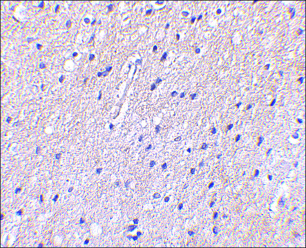 Anti-Nhe-1 (ab2) antibody produced in rabbit affinity isolated antibody, buffered aqueous solution