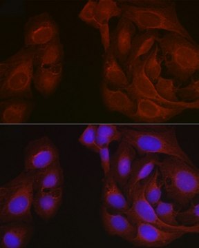 Anti- Notch1 antibody produced in rabbit