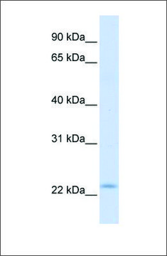 Anti-REEP1 (ab2) antibody produced in rabbit affinity isolated antibody