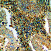 Anti-phospho-Catenin-β (pThr41/Ser45) antibody produced in rabbit affinity isolated antibody