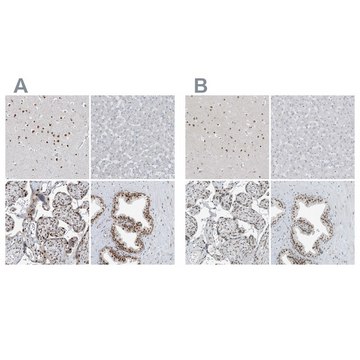 Anti-WRNIP1 antibody produced in rabbit Prestige Antibodies&#174; Powered by Atlas Antibodies, affinity isolated antibody, buffered aqueous glycerol solution